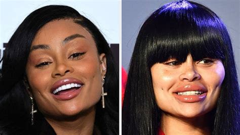 blac chyna before and after 2023